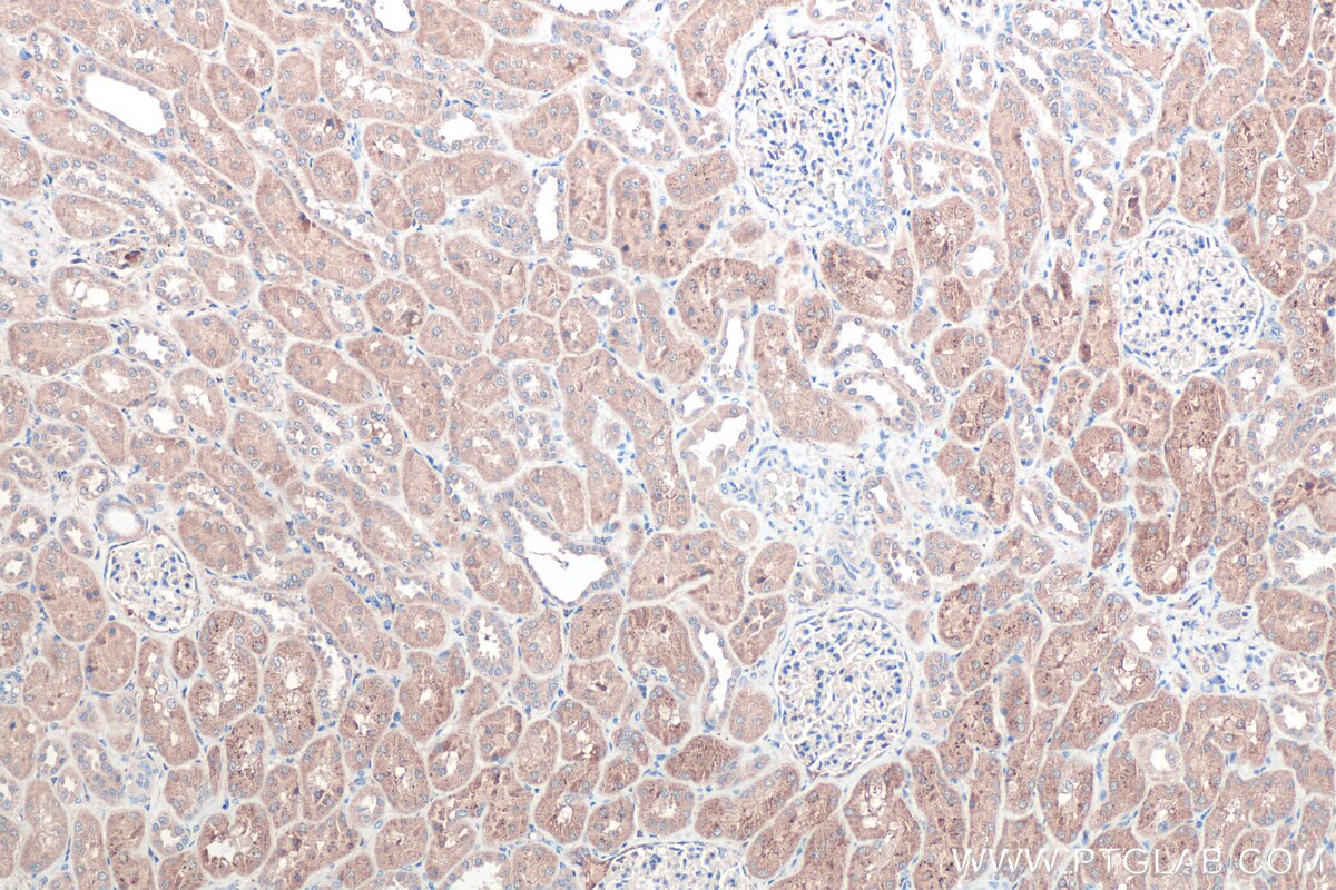 Immunohistochemistry (IHC) staining of human kidney tissue using MYO19 Polyclonal antibody (23906-1-AP)