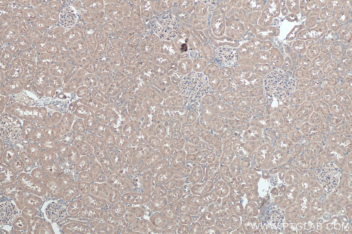Immunohistochemistry (IHC) staining of rat kidney tissue using MYO19 Polyclonal antibody (23906-1-AP)