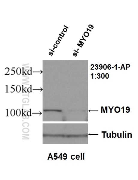 Western Blot (WB) analysis of A549 cells using MYO19 Polyclonal antibody (23906-1-AP)