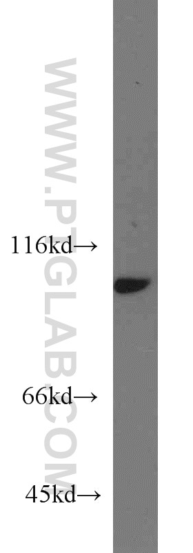 Western Blot (WB) analysis of A549 cells using MYO19 Polyclonal antibody (23906-1-AP)