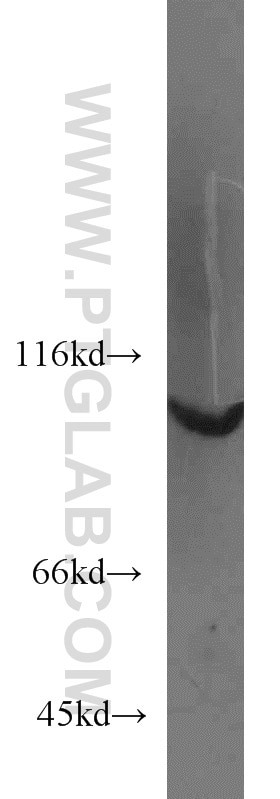 Western Blot (WB) analysis of COS-7 cells using MYO19 Polyclonal antibody (23906-1-AP)