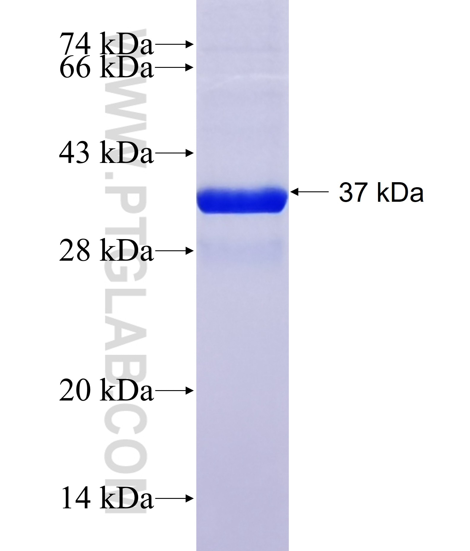 MYO19 fusion protein Ag40956 SDS-PAGE MYO19 fusion protein Ag40956 SDS-PAGE