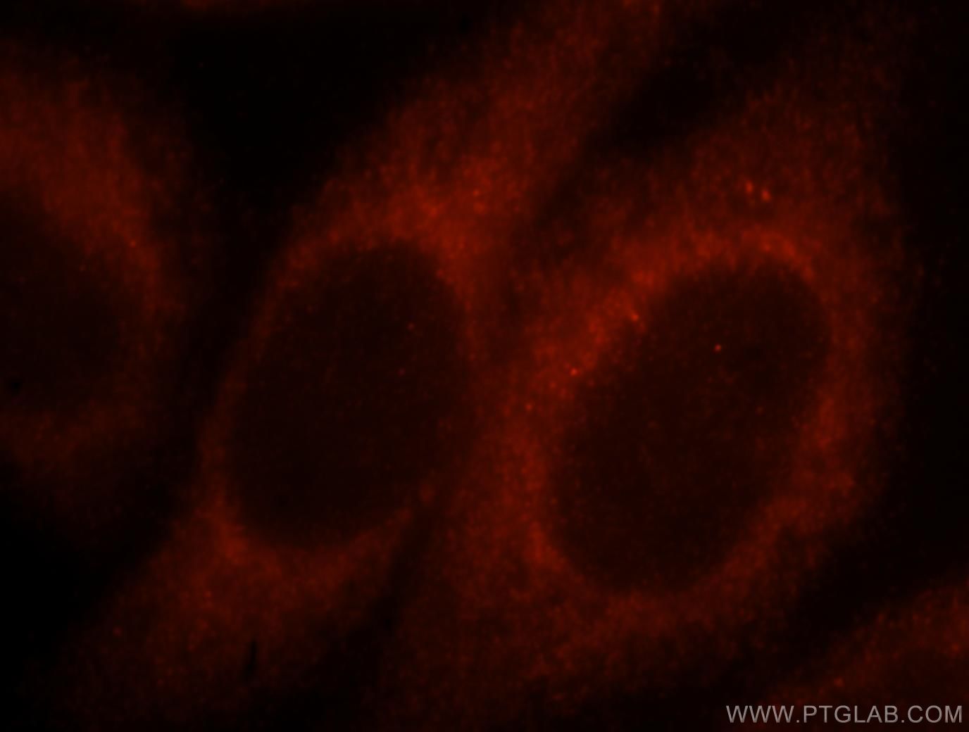 Immunofluorescence (IF) / fluorescent staining of HepG2 cells using MYO1A Polyclonal antibody (17499-1-AP)