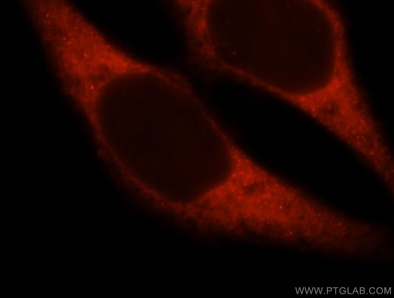 Immunofluorescence (IF) / fluorescent staining of HeLa cells using MYO1A Polyclonal antibody (17499-1-AP)