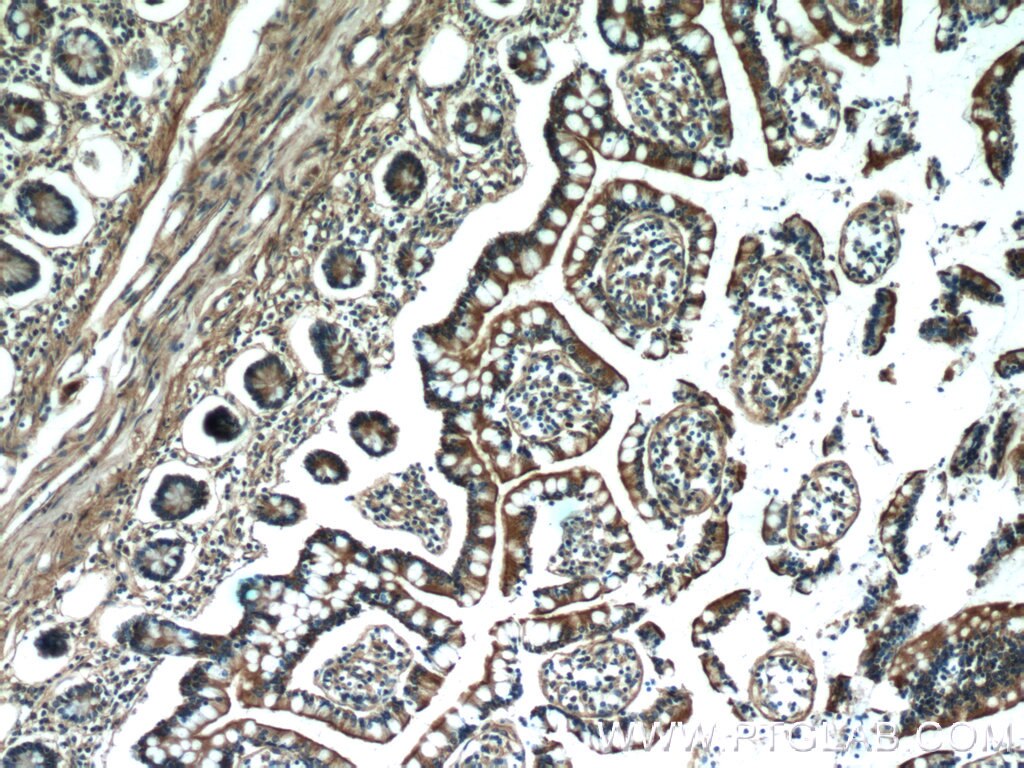 Immunohistochemistry (IHC) staining of human small intestine tissue using MYO1A Polyclonal antibody (17499-1-AP)