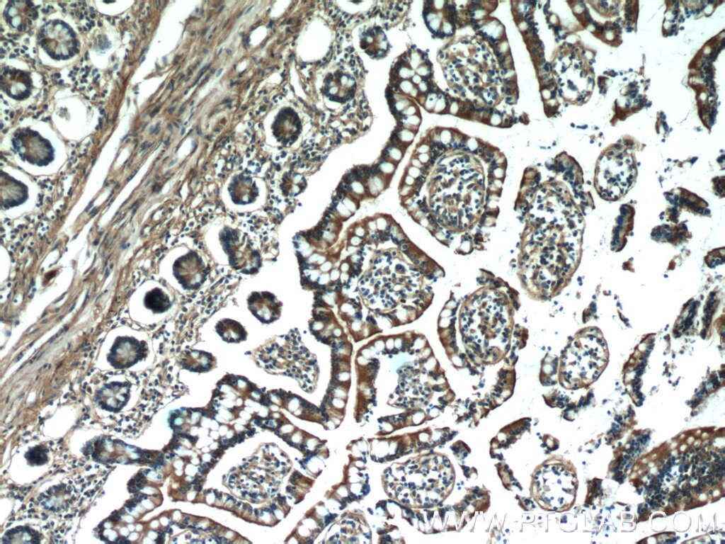 IHC staining of human small intestine using 17499-1-AP