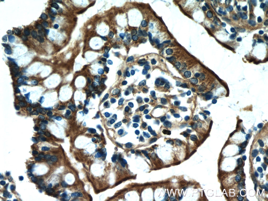 Immunohistochemistry (IHC) staining of human small intestine tissue using MYO1A Polyclonal antibody (17499-1-AP)