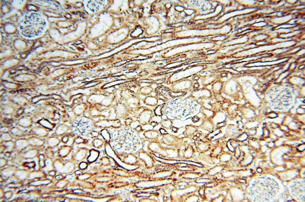 Immunohistochemistry (IHC) staining of human kidney tissue using MYO1A Polyclonal antibody (17499-1-AP)