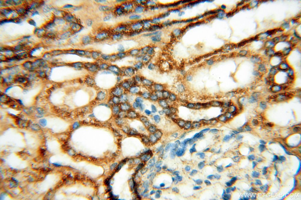 Immunohistochemistry (IHC) staining of human kidney tissue using MYO1A Polyclonal antibody (17499-1-AP)