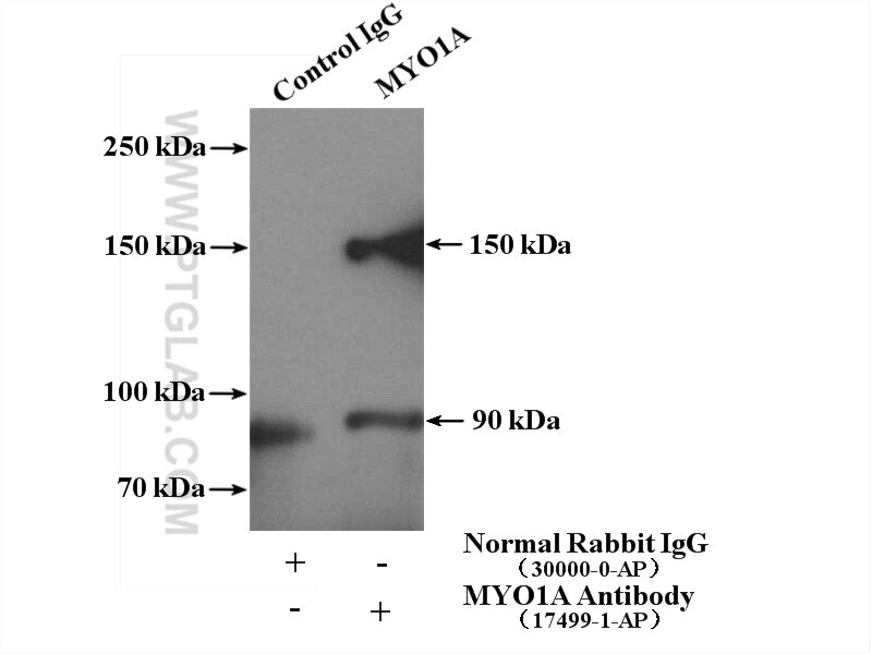 Immunoprecipitation (IP) experiment of HeLa cells using MYO1A Polyclonal antibody (17499-1-AP)