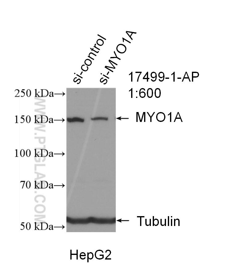 Western Blot (WB) analysis of HepG2 cells using MYO1A Polyclonal antibody (17499-1-AP)