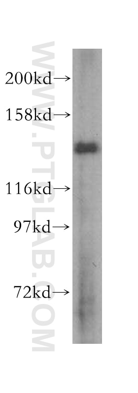 Western Blot (WB) analysis of HepG2 cells using MYO1A Polyclonal antibody (17499-1-AP)
