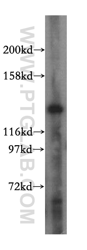 Western Blot (WB) analysis of HeLa cells using MYO1A Polyclonal antibody (17499-1-AP)