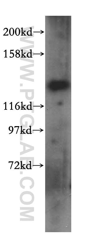 Western Blot (WB) analysis of A431 cells using MYO1A Polyclonal antibody (17499-1-AP)