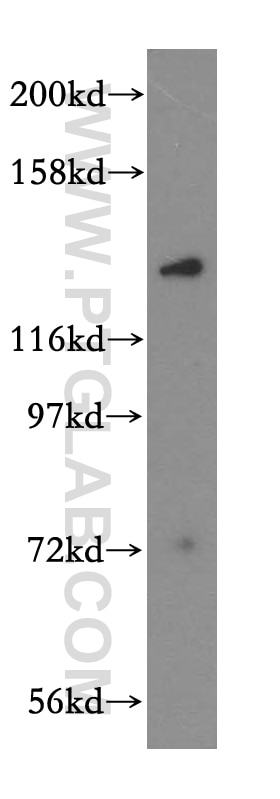 Western Blot (WB) analysis of mouse brain tissue using MYO1A Polyclonal antibody (17499-1-AP)