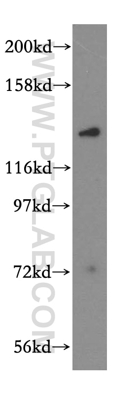 WB analysis of mouse brain using 17499-1-AP