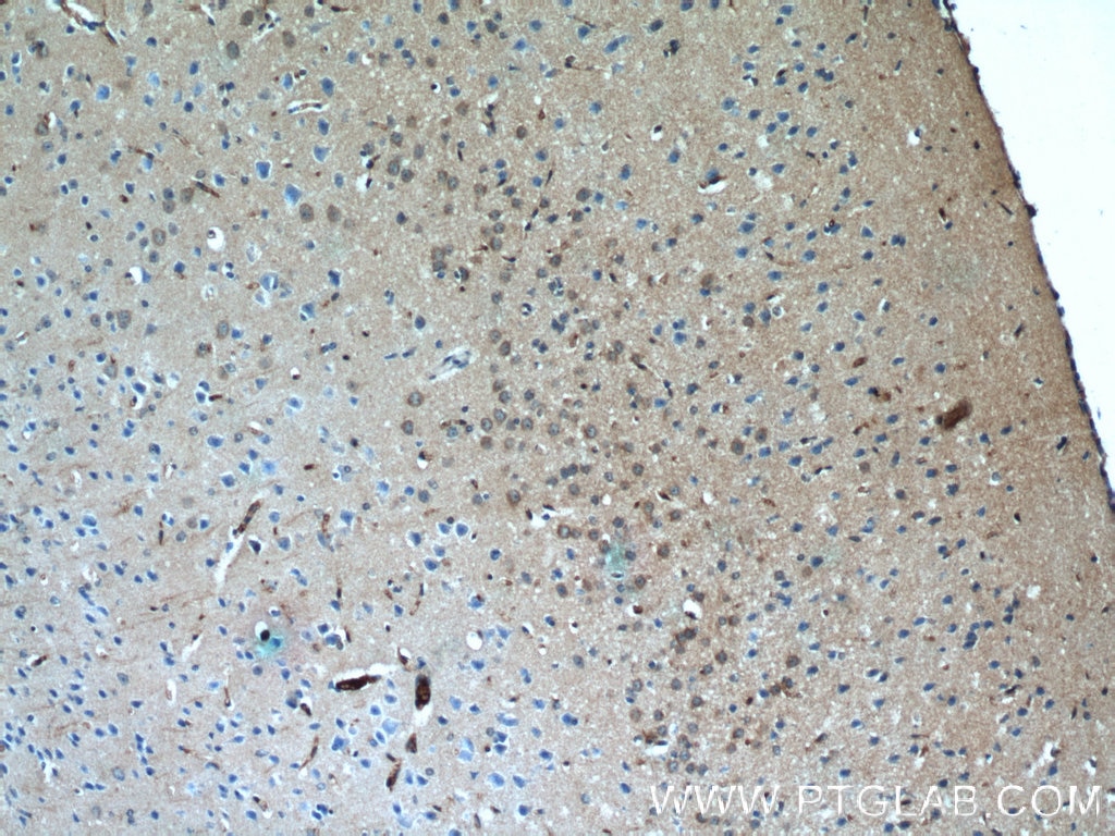 Immunohistochemistry (IHC) staining of mouse brain tissue using MYO1B Polyclonal antibody (15012-1-AP)