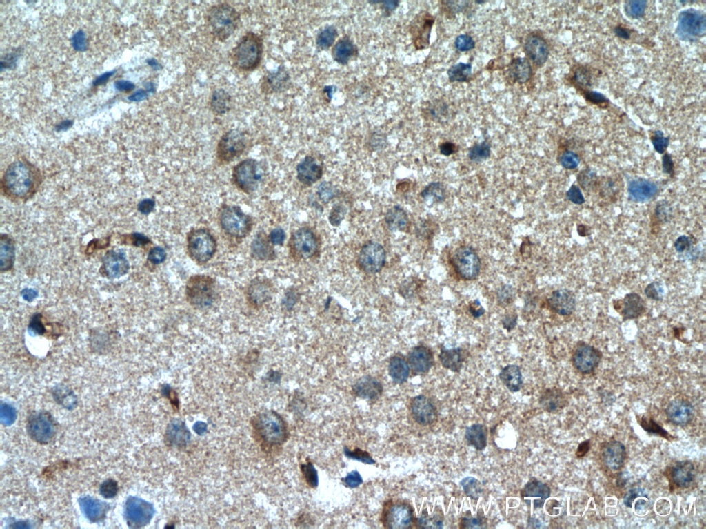 Immunohistochemistry (IHC) staining of mouse brain tissue using MYO1B Polyclonal antibody (15012-1-AP)