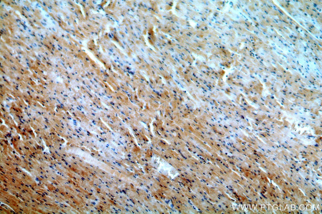 Immunohistochemistry (IHC) staining of human heart tissue using MYO1B Polyclonal antibody (15012-1-AP)