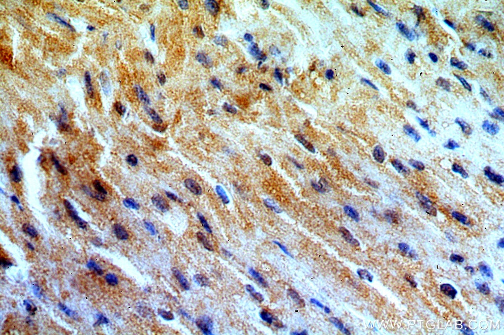 Immunohistochemistry (IHC) staining of human heart tissue using MYO1B Polyclonal antibody (15012-1-AP)