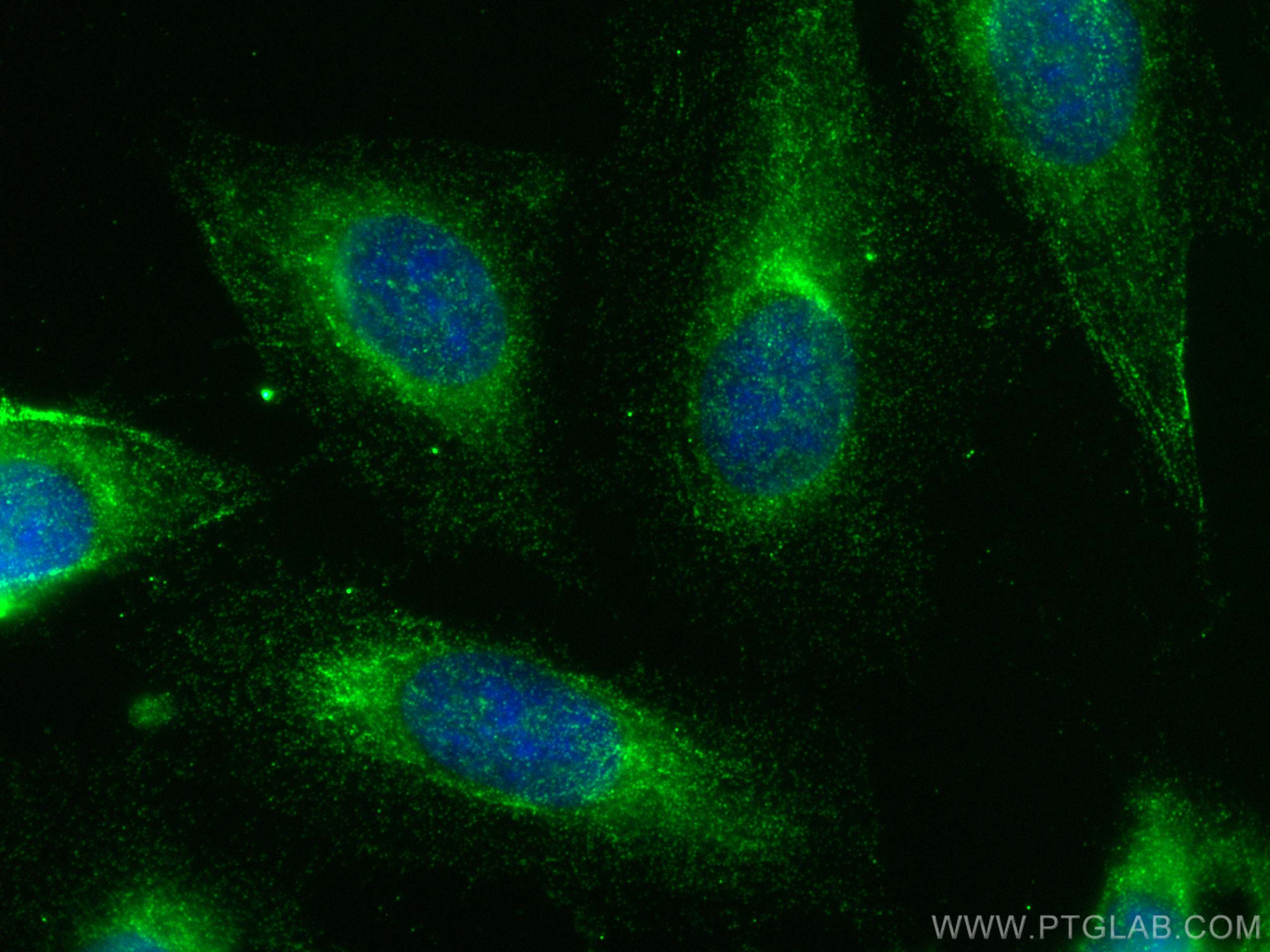 Immunofluorescence (IF) / fluorescent staining of U2OS cells using MYO1C Polyclonal antibody (17969-1-AP)