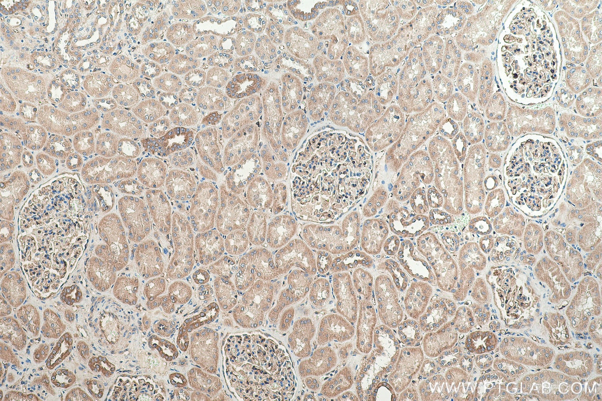 Immunohistochemistry (IHC) staining of human kidney tissue using MYO1C Polyclonal antibody (17969-1-AP)