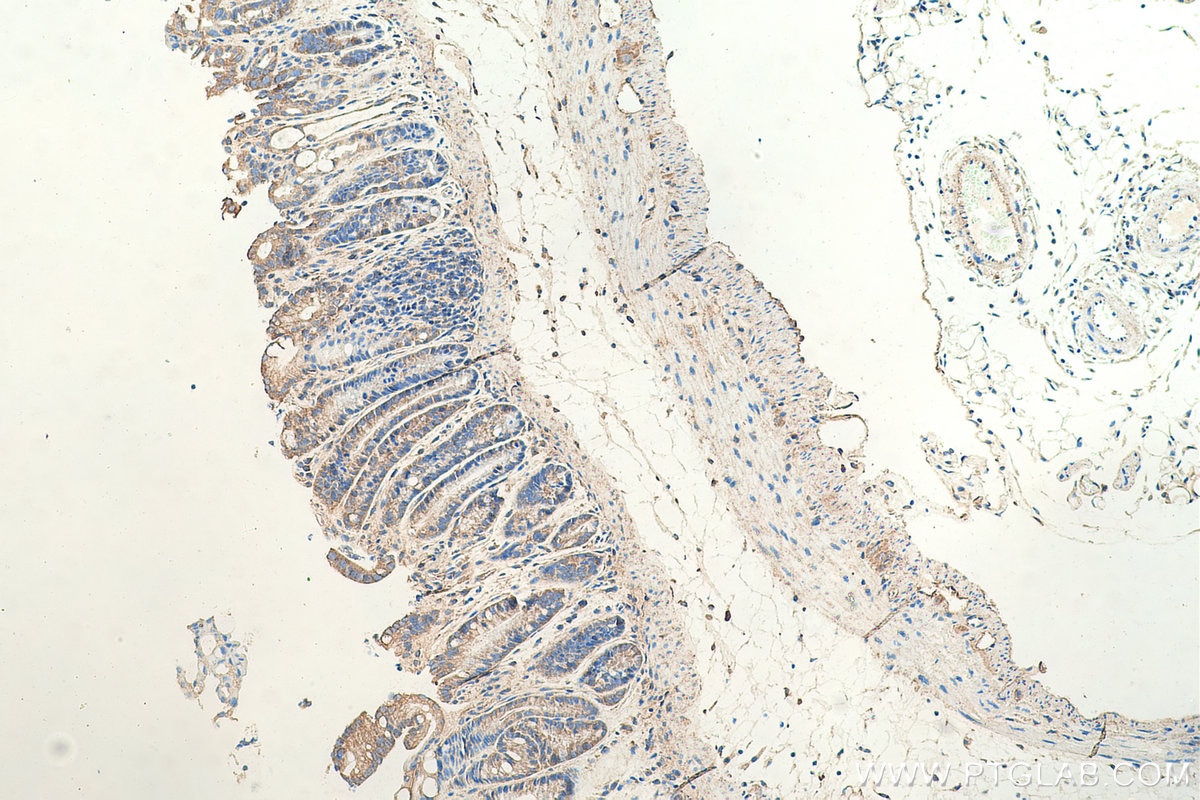 Immunohistochemistry (IHC) staining of mouse colon tissue using MYO1C Polyclonal antibody (17969-1-AP)