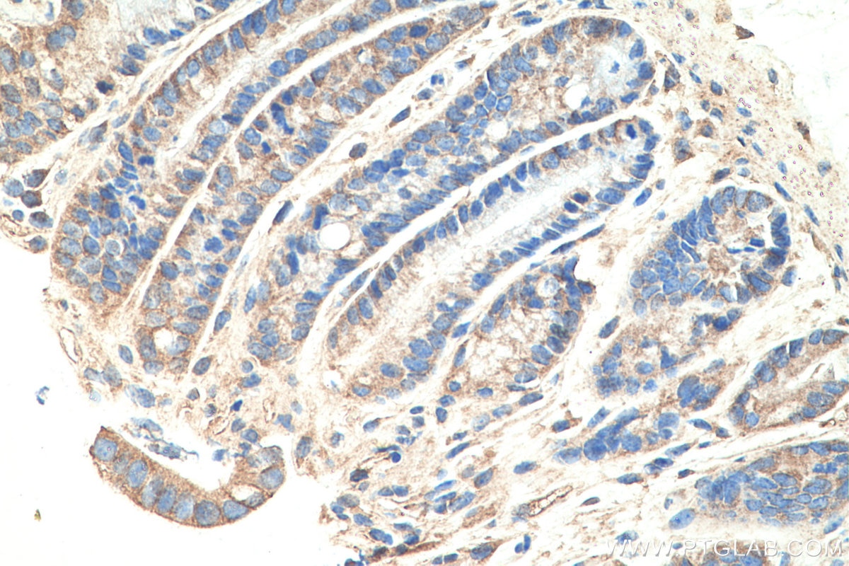 Immunohistochemistry (IHC) staining of mouse colon tissue using MYO1C Polyclonal antibody (17969-1-AP)