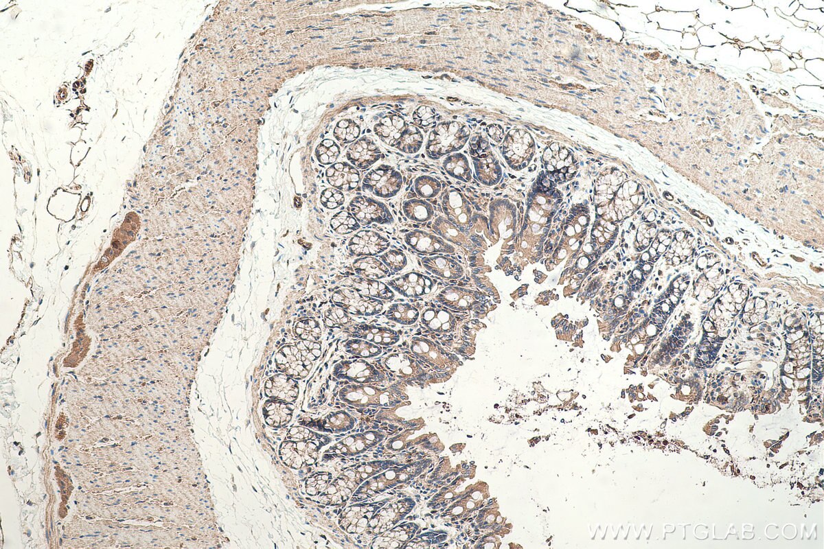 Immunohistochemistry (IHC) staining of rat colon tissue using MYO1C Polyclonal antibody (17969-1-AP)