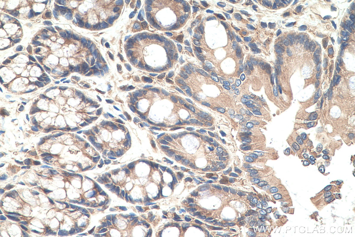 Immunohistochemistry (IHC) staining of rat colon tissue using MYO1C Polyclonal antibody (17969-1-AP)