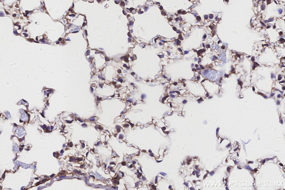 Immunohistochemistry (IHC) staining of mouse lung tissue using MYO1D Polyclonal antibody (14028-1-AP)