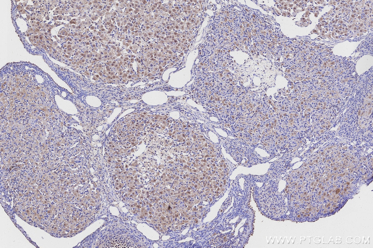 Immunohistochemistry (IHC) staining of rat ovary tissue using MYO1D Polyclonal antibody (14028-1-AP)