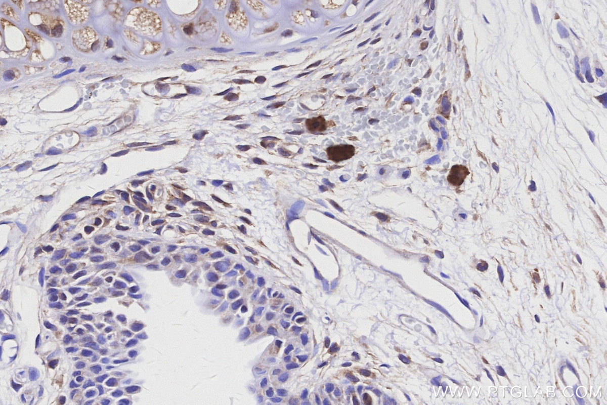 Immunohistochemistry (IHC) staining of rat thyroid gland tissue using MYO1D Polyclonal antibody (14028-1-AP)