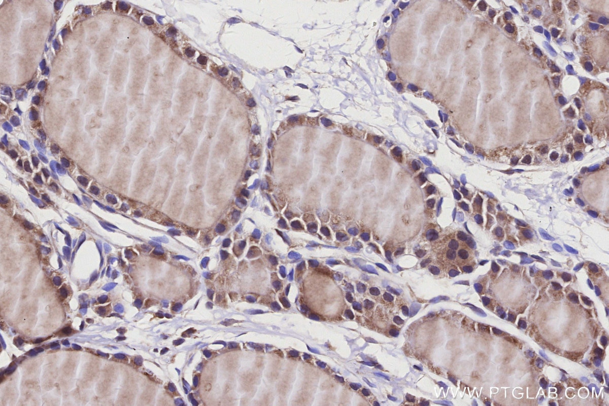 Immunohistochemistry (IHC) staining of rat thyroid gland tissue using MYO1D Polyclonal antibody (14028-1-AP)