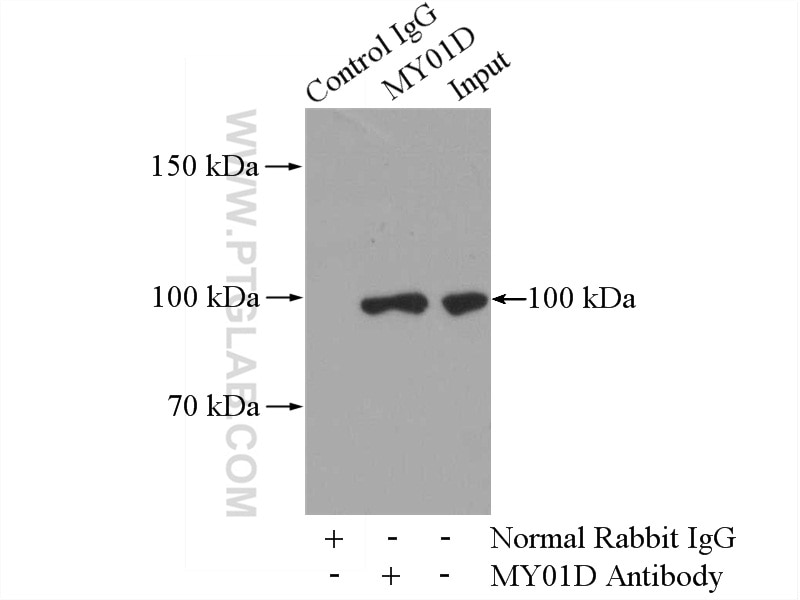 Immunoprecipitation (IP) experiment of mouse lung tissue using MYO1D Polyclonal antibody (14028-1-AP)