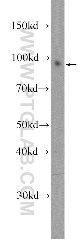 Western Blot (WB) analysis of mouse brain tissue using MYO1D Polyclonal antibody (14028-1-AP)