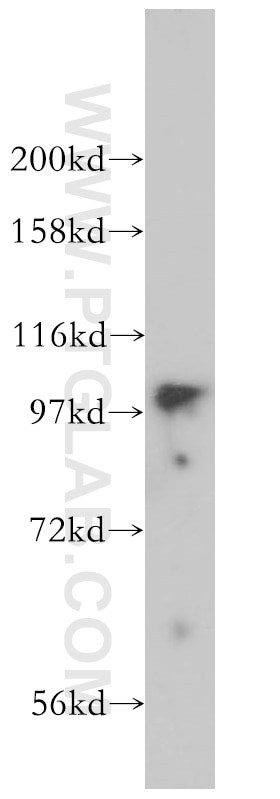 Western Blot (WB) analysis of mouse lung tissue using MYO1D Polyclonal antibody (14028-1-AP)