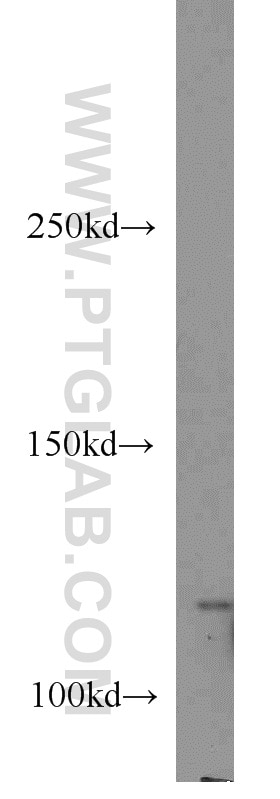 Western Blot (WB) analysis of HeLa cells using MYO1E Polyclonal antibody (17768-1-AP)