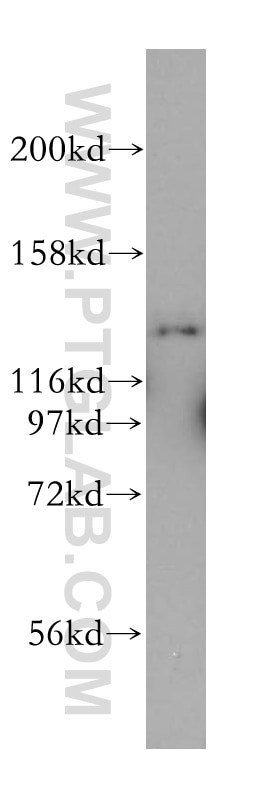 Western Blot (WB) analysis of HeLa cells using MYO1E Polyclonal antibody (17768-1-AP)