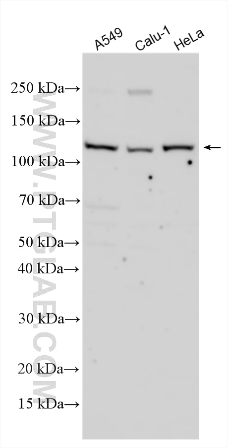 WB analysis using 28771-1-AP Western Blot (WB) analysis of various lysates using MYO1E Polyclonal antibody (28771-1-AP)