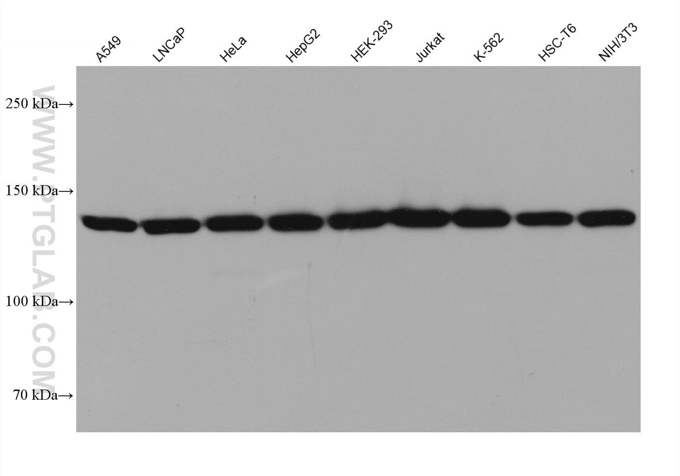 Western Blot (WB) analysis of various lysates using MYO1E Monoclonal antibody (68152-1-Ig)