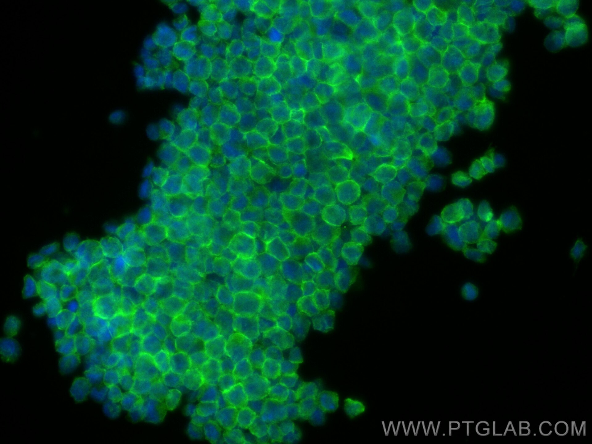 Immunofluorescence (IF) / fluorescent staining of THP-1 cells using MYO1F Polyclonal antibody (28841-1-AP)