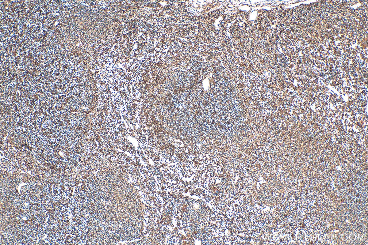 Immunohistochemistry (IHC) staining of mouse spleen tissue using MYO1F Polyclonal antibody (28841-1-AP)