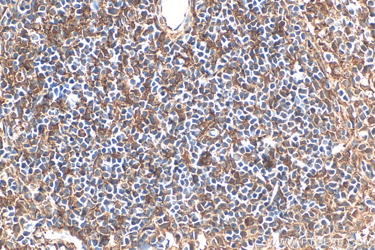 Immunohistochemistry (IHC) staining of mouse spleen tissue using MYO1F Polyclonal antibody (28841-1-AP)