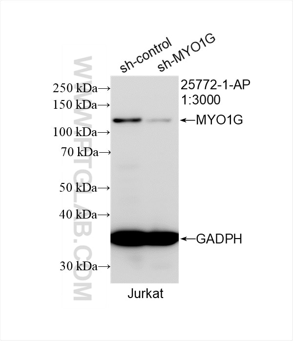 Western Blot (WB) analysis of Jurkat cells using MYO1G Polyclonal antibody (25772-1-AP)