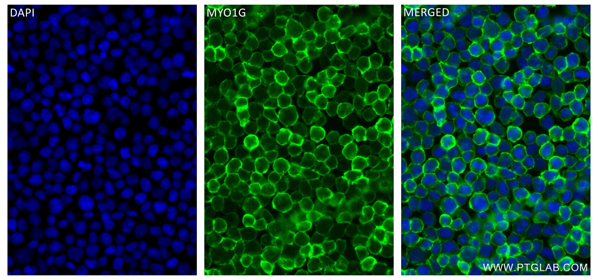 Immunofluorescence (IF) / fluorescent staining of Jurkat cells using MYO1G Recombinant antibody (83556-5-RR)