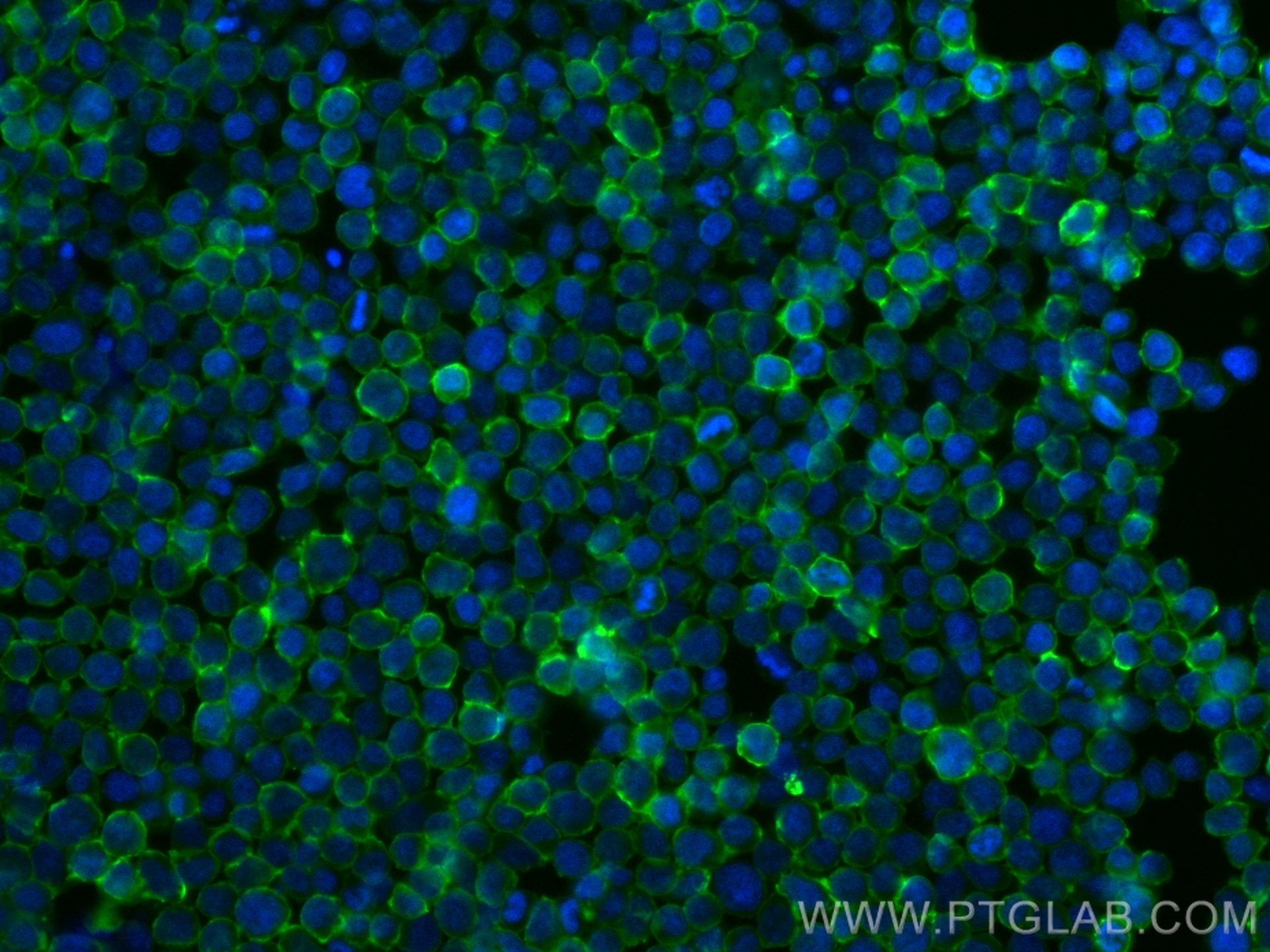 Immunofluorescence (IF) / fluorescent staining of Jurkat cells using CoraLite® Plus 488-conjugated MYO1G Recombinant an (CL488-83556-5)