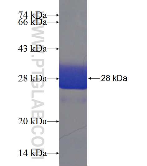 MYO1G fusion protein Ag22696 SDS-PAGE