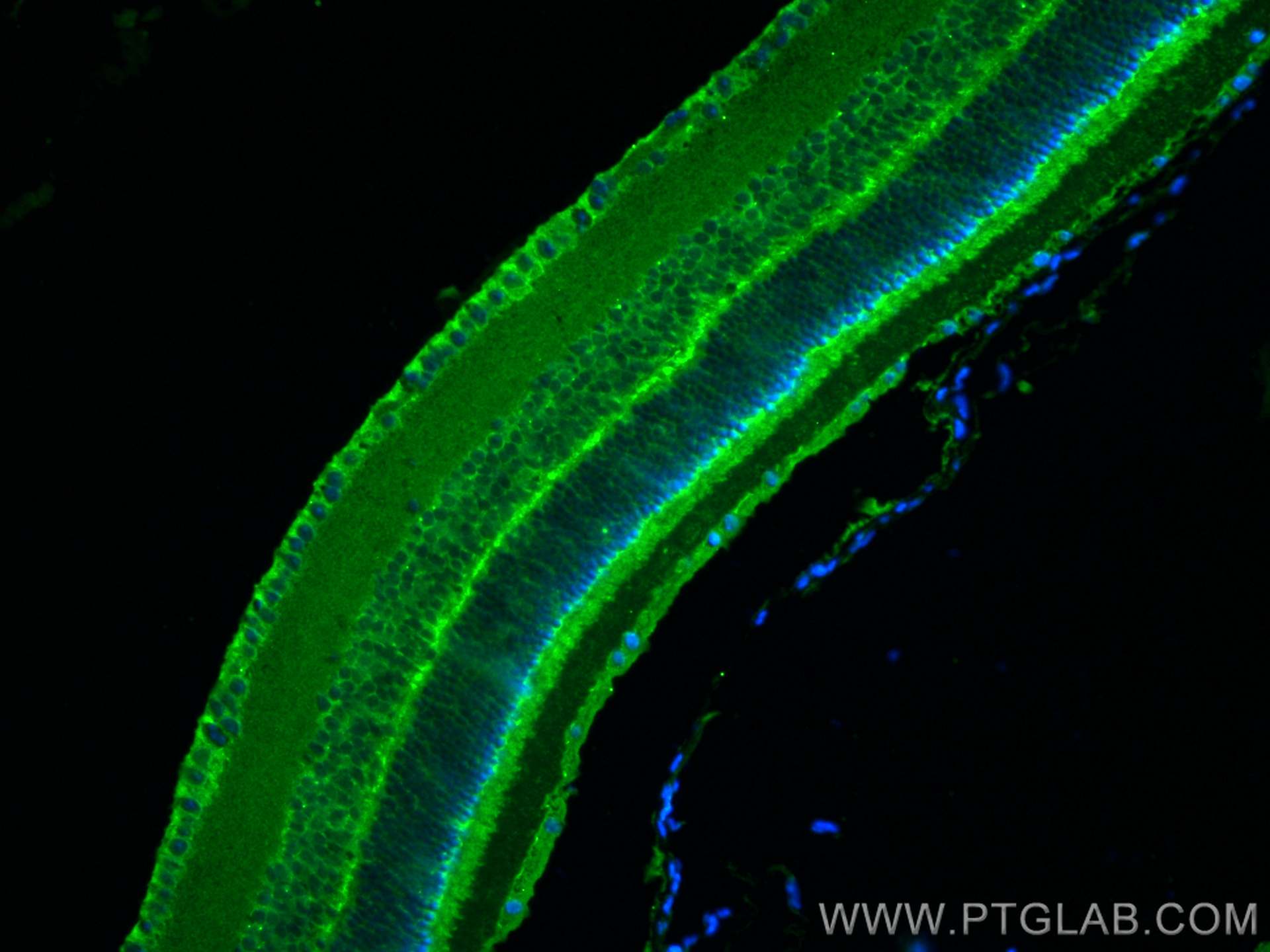 Immunofluorescence (IF) / fluorescent staining of mouse eye tissue using MYO3A Polyclonal antibody (28562-1-AP)