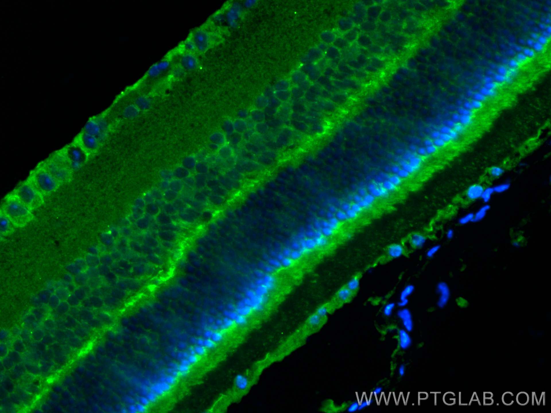 Immunofluorescence (IF) / fluorescent staining of mouse eye tissue using MYO3A Polyclonal antibody (28562-1-AP)